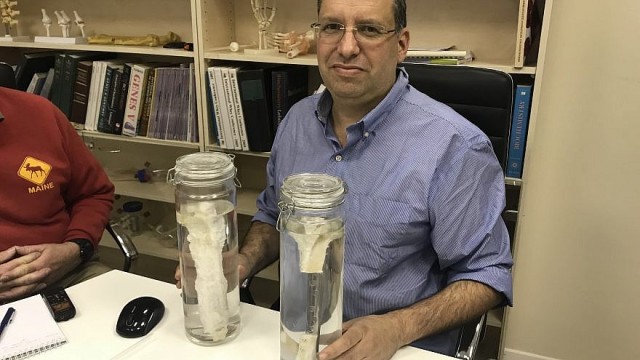 Laboratóriumban növesztett csontot ültettek emberbe 2018. 02. 28.