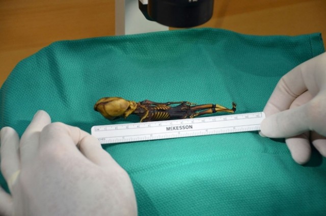 Az Ata nevű múmia vizsgálat közben