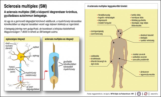 Sclerosis multiplex (SM)